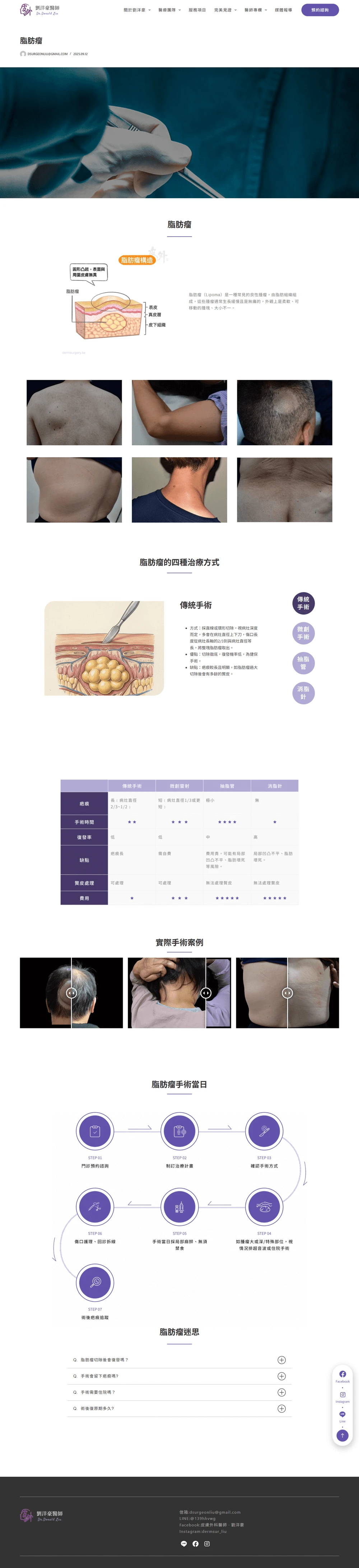 劉洋豪醫師網站案例 療程介紹